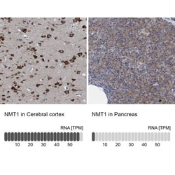 NMT1 Antibody, Novus Biologicals:Antibodies:Primary Antibodies
