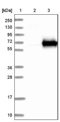 NMT1 Antibody, Novus Biologicals:Antibodies:Primary Antibodies