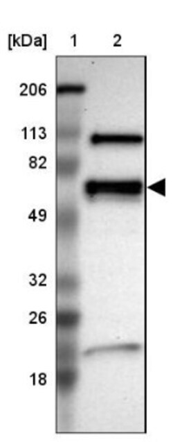 NMT2 Antibody, Novus Biologicals:Antibodies:Primary Antibodies