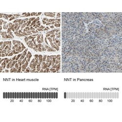 NNT Antibody, Novus Biologicals 0.1mL; Unlabeled:Antibodies, Polyclonal