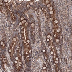 NOA1 Antibody, Novus Biologicals:Antibodies:Primary Antibodies