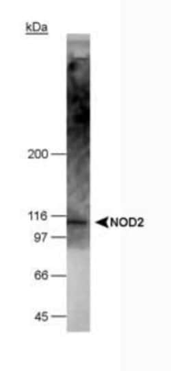 NOD2 Antibody (2D9) - BSA Free, Novus Biologicals 0.1mL; Unlabeled:Antibodies,