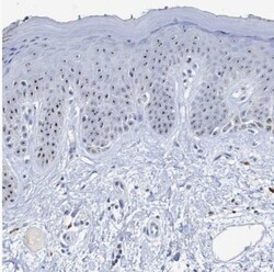NOL1 Antibody, Novus Biologicals 0.1mL; Unlabeled:Antibodies, Polyclonal