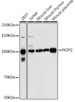 NOL1 Rabbit anti-Human, Mouse, Polyclonal, Novus Biologicals 20 &mu;g;
