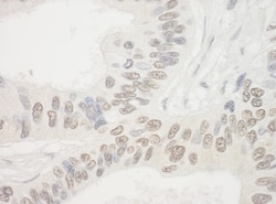 NOL10 Antibody, Novus Biologicals 100 &mu;L | Buy Online | Novus Biologicals | Fisher Scientific