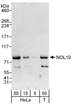 NOL10 Antibody, Novus Biologicals 100 &mu;L | Buy Online | Novus Biologicals | Fisher Scientific