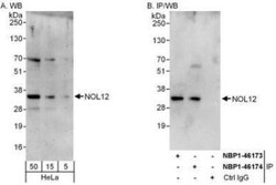 NOL12 Antibody, Novus Biologicals 0.1mg; Unlabeled:Antibodies, Polyclonal