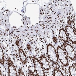 NOLA1 Antibody, Novus Biologicals 25 &mu;L | Buy Online | Novus Biologicals | Fisher Scientific