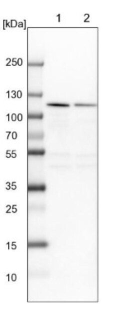 NOP14 Antibody, Novus Biologicals 0.1mL; Unlabeled:Antibodies, Polyclonal