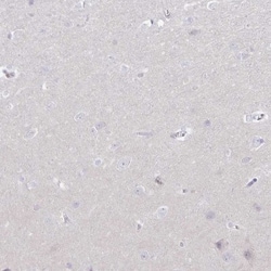 NOV/CCN3 Antibody, Novus Biologicals 0.1mL; Unlabeled:Antibodies, Polyclonal