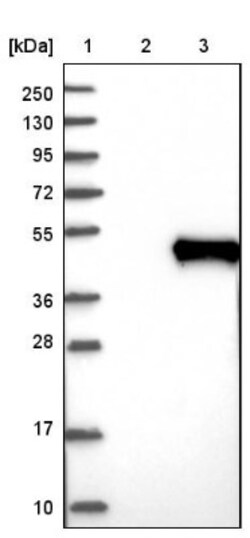 NOV/CCN3 Antibody, Novus Biologicals 0.1mL; Unlabeled:Antibodies, Polyclonal