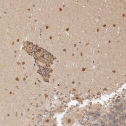 NPAS2 Antibody, Novus Biologicals:Antibodies:Primary Antibodies