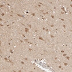 NPAS2 Antibody, Novus Biologicals:Antibodies:Primary Antibodies