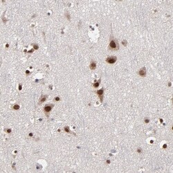 NPAS3 Antibody, Novus Biologicals 0.1mL; Unlabeled:Antibodies, Polyclonal