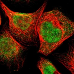 NPDC-1 Antibody, Novus Biologicals 0.1mL; Unlabeled:Antibodies, Polyclonal