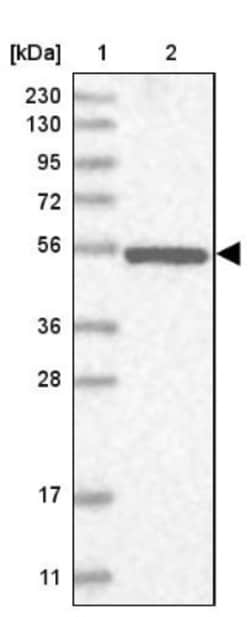 NPEPL1 Antibody, Novus Biologicals 0.1mL; Unlabeled:Antibodies, Polyclonal