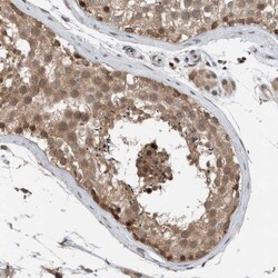 NPLOC4 Antibody, Novus Biologicals 25 &mu;L; Unlabeled:Antibodies, Polyclonal