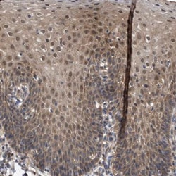 NPLOC4 Antibody, Novus Biologicals:Antibodies:Primary Antibodies