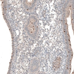 NPRL3 Antibody, Novus Biologicals 0.1mL; Unlabeled:Antibodies, Polyclonal