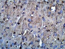 NPY2R Antibody, Novus Biologicals 100 &mu;g | Buy Online | Novus Biologicals | Fisher Scientific