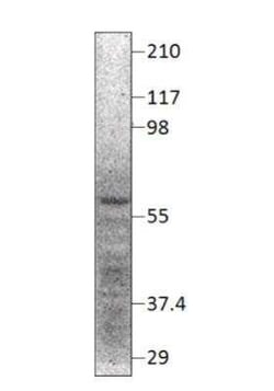 NPY5R Antibody, Novus Biologicals 100 &mu;g | Buy Online | Novus Biologicals | Fisher Scientific