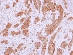 NQO-1 Antibody, Novus Biologicals 0.1mg; Unlabeled:Antibodies, Polyclonal