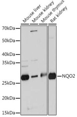 NQO-2 Rabbit anti-Human, Mouse, Rat, Clone: 5E0B2, Novus Biologicals:Antibodies:Primary