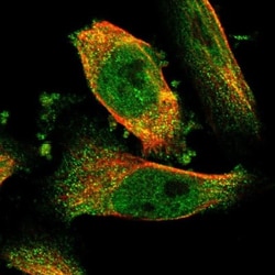NQO-2 Antibody, Novus Biologicals:Antibodies:Primary Antibodies