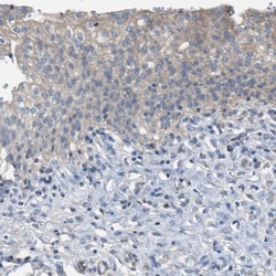 NQO-2 Antibody, Novus Biologicals:Antibodies:Primary Antibodies