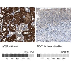 NQO-2 Antibody, Novus Biologicals:Antibodies:Primary Antibodies