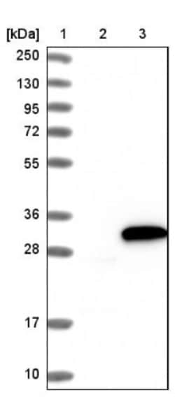 NQO-2 Antibody, Novus Biologicals:Antibodies:Primary Antibodies