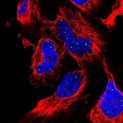 CLC Antibody, Novus Biologicals 0.1mL; Unlabeled:Antibodies, Polyclonal