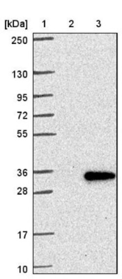 CLC Antibody, Novus Biologicals 0.1mL; Unlabeled:Antibodies, Polyclonal
