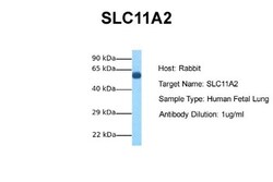 NRAMP2/SLC11A2/DMT1 Antibody, Novus Biologicals 0.05mg; Unlabeled:Antibodies,