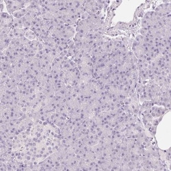 NRF3 Antibody, Novus Biologicals 0.1mL; Unlabeled:Antibodies, Polyclonal