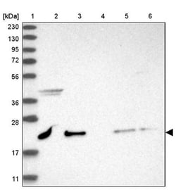 NRIF3 Antibody, Novus Biologicals 25 &mu;L; Unlabeled:Antibodies, Polyclonal