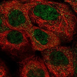 NRK1 Antibody, Novus Biologicals:Antibodies:Primary Antibodies