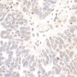 NRSF Antibody, Novus Biologicals 0.1mg; Unlabeled:Antibodies, Polyclonal