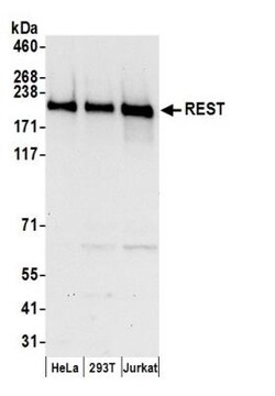 NRSF Antibody, Novus Biologicals 0.1mg; Unlabeled:Antibodies, Polyclonal