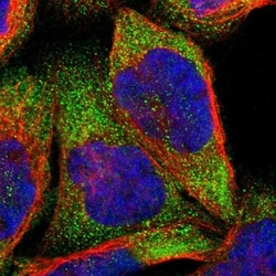 NS1-BP Antibody, Novus Biologicals 25 &mu;L | Buy Online | Novus Biologicals | Fisher Scientific