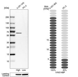 NS1-BP Antibody, Novus Biologicals 25 &mu;L | Buy Online | Novus Biologicals | Fisher Scientific