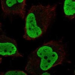 NSBP1 Rabbit anti-Human, Polyclonal, Novus Biologicals 25 &mu;g | Buy Online | Novus Biologicals | Fisher Scientific