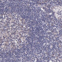 NSDHL Antibody, Novus Biologicals:Antibodies:Primary Antibodies