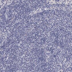 NSDHL Antibody, Novus Biologicals:Antibodies:Primary Antibodies