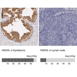 NSDHL Antibody, Novus Biologicals:Antibodies:Primary Antibodies