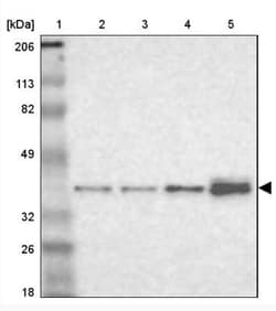 NSDHL Antibody, Novus Biologicals:Antibodies:Primary Antibodies