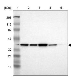 NSDHL Antibody, Novus Biologicals:Antibodies:Primary Antibodies