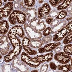 NSMCE1 Antibody, Novus Biologicals 25 &mu;L | Buy Online | Novus Biologicals | Fisher Scientific