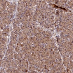 NSMCE1 Antibody, Novus Biologicals 25 &mu;L | Buy Online | Novus Biologicals | Fisher Scientific