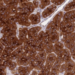 NSMCE1 Antibody, Novus Biologicals 25 &mu;L | Buy Online | Novus Biologicals | Fisher Scientific